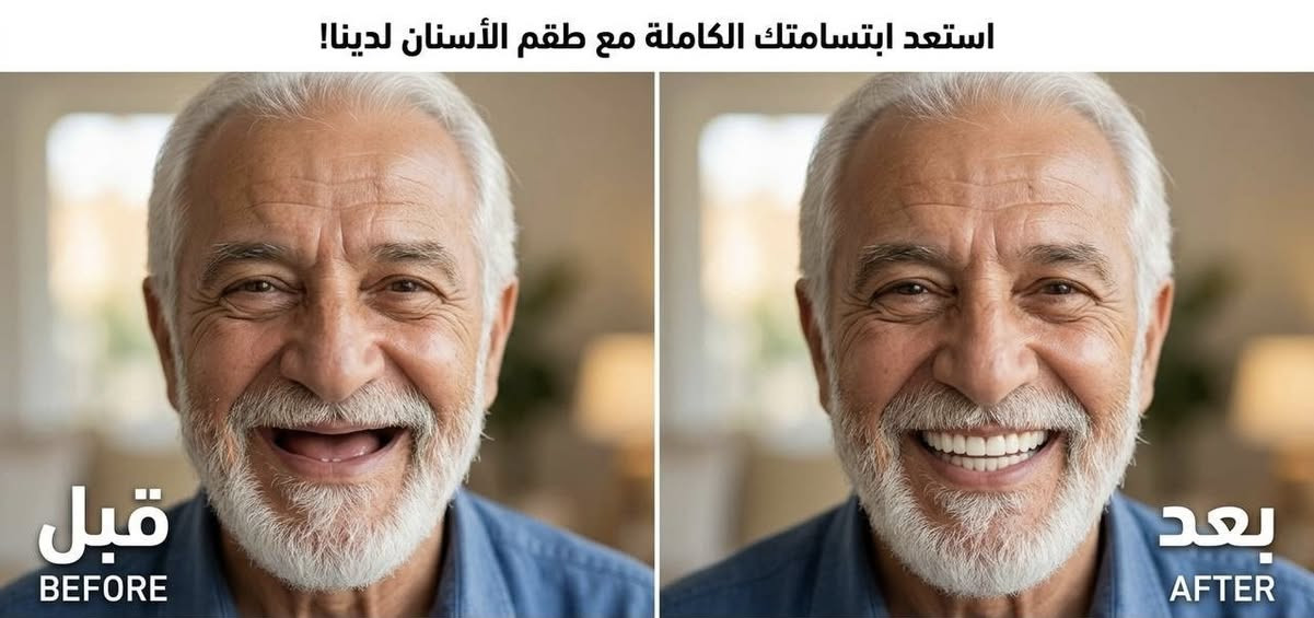 بشرى سارة لأهلنا في ميسان! 🦷✨
فرصة لعمل طقم أسنان كلي (مجاني بالكامل) لكبار السن الفاقدين لأسنانهم بالكامل.
العمل يتم بأجود المواد وتحت إشراف مباشر من كبار أطباء وأساتذة كلية طب الأسنان في جامعة ميسان.
📍 الموقع: جامعة ميسان - كلية طب الأسنان.
📞 للحجز والتواصل: راسلني على الخاص او على الواتساب ***********
شارك المنشور وساهم في إرجاع ابتسامة لشخص عزيز! 🤍
