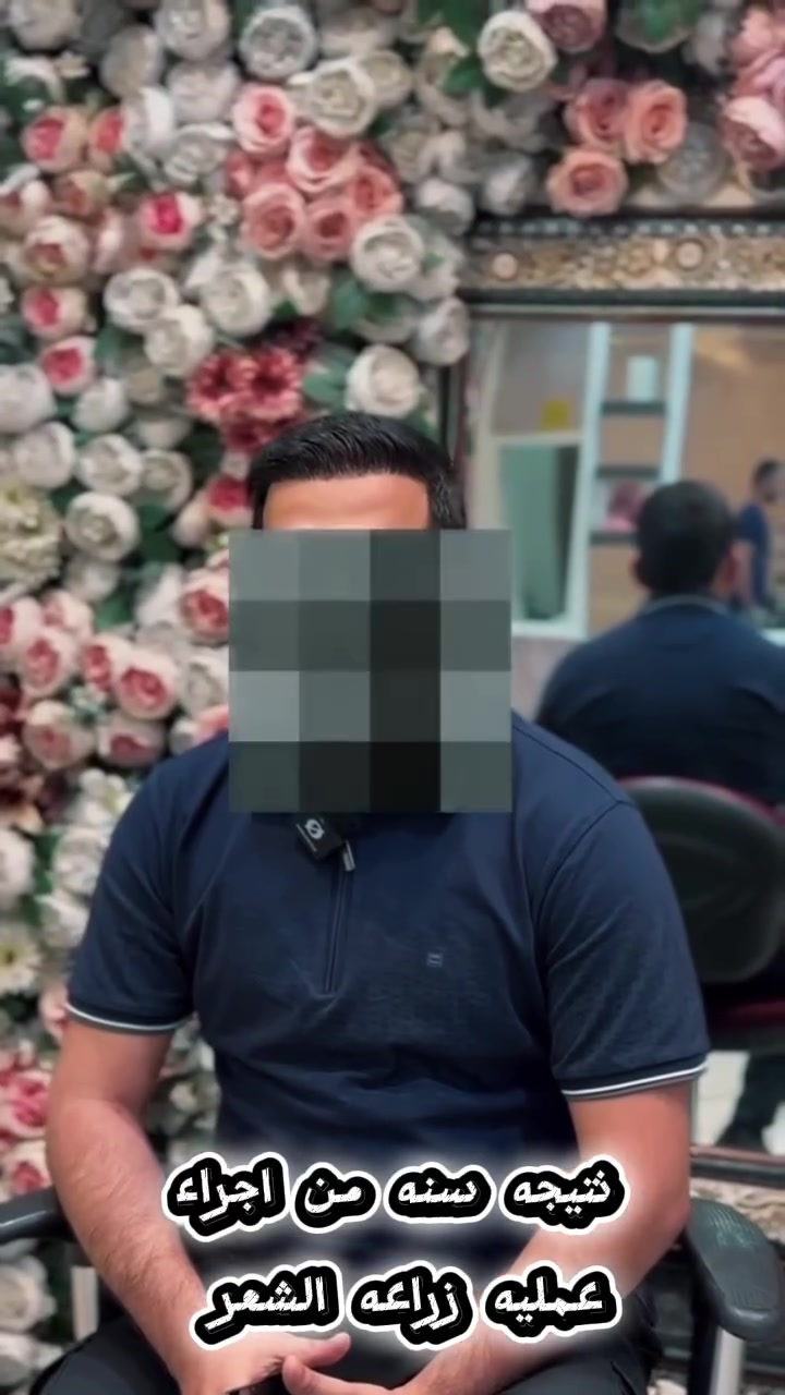 نتيجة سنة لأحد زبائن مركز المنصور🤍✔️

#المركز الاول بالعراق لزراعه الشعر بشهاده الزبائن والنتائج 
(اختصاصنه المانحات الضعيفه وبكثافه ١٠٠٪؜ )

غير مظهرك ورجع شبابك بساعات قليله وبدون الم ✅❤️

اختياركم النه هو سر نجاحنا❤️🥇

#وداعآ_للصلع_مع_مركز_المنصور_التخصصي_لزراعه_الشعر_🥇❤️
بعدنه مستمرين وياكم بعروضنه
 
•الشغل الدقيق والكثافه العاليه 100‎%‎ 
 • عدد بصيلات مفتوح يصل الى (7000) الف بصيله او اكثر 
 • فتح القنوات بتقنيه الزفير
 (الاحدث عالميآ بالزراعه) 

▪️كادر طبي مختص بزراعة الشعر 🩺
▪️حقيبه علاجيه متكامله بعد الزراعه 🧳
▪️ جلسات بلازمه مفعله مع ميزو ثيرابي اسباني للشعر المزروع 🌡🩸
▪️ جلسات ميزو وايت نظاره للبشره
 ▪️سحب عدد مفتوح من البصيلات مع ضمان عدم حصول اي تشوه في المنطقه المانحه 
▪️تحاليل شامله قبل العمليه 🧪
▪️ معاينه مجانيه لمده سنه بعد العمليه 
▪️غسل الشعر المزروع لمده 10 ايام 
بعد العمليه 🧴🚿
▪️وجبة طعام صحيه اثناء العمليه 🥪
▪️ شهاده ضمان مدى الحياة بكثافه وقوة وعدم تساقط الشعر المزروع 📃🤍

للحجز والاستفسار 
📥***********

بغداد - المنصور - شارع الرواد مقابل مرطبات مشمشه📍
