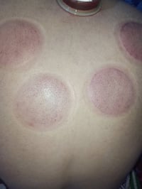 حجامة أهل البيت • منهج الإمام الرضا • كربلاء الحر السوادة