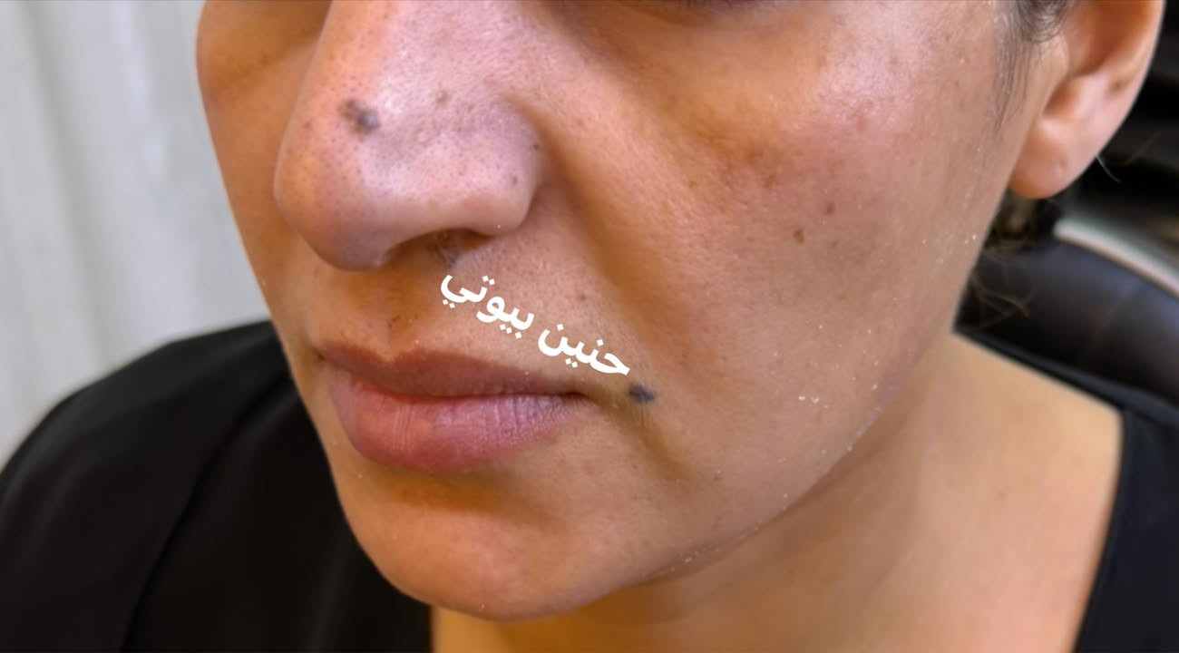 حنين بيوتي 🍒مصنع الحلويات 🍒


**إذا كنت صاحب هذا الإعلان وتريد حذفه لأي سبب، رجاءا أرسل رسالة إلى الدعم الفني**