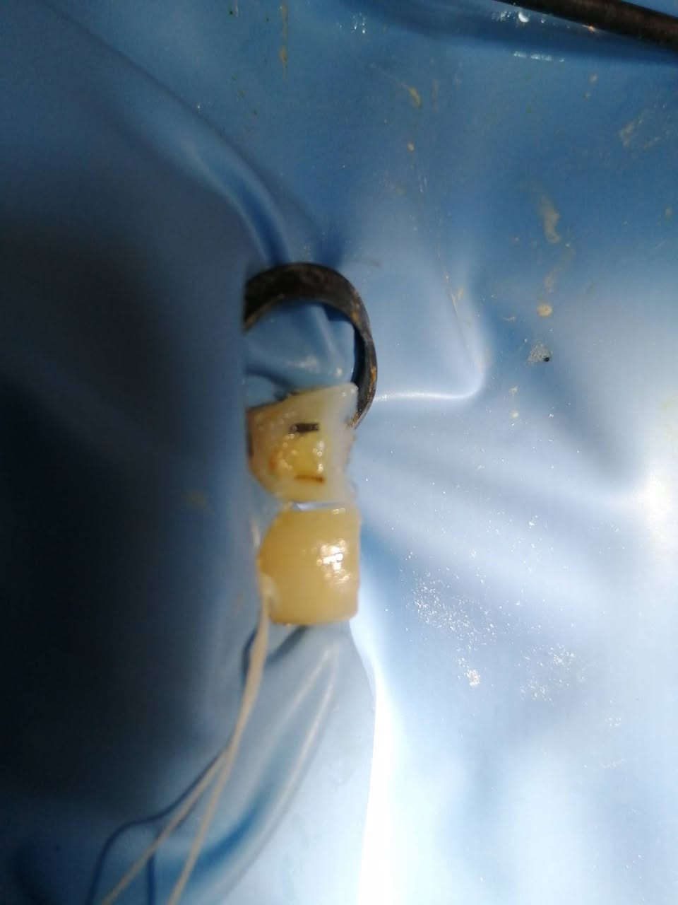 ترميم السن الأمامي المكسور ..
د مهند عبد الجواد الطحان الهاشمي
ماجستير ودبلوم عالي تعويض الأسنان.. سايدين مستشفى #القيارهالعام.. للحجز والاستفسار التواصل على الرقم ***********# مجاور صيدليه عبدالله المعماري.. طابق ارضى.
