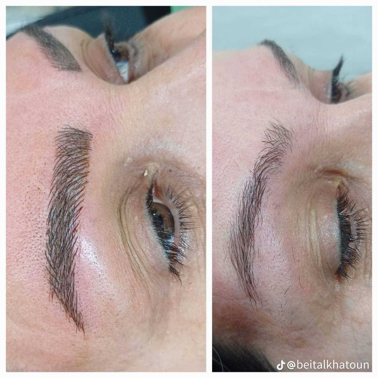 قسم التاتو  في صالون خاتو  العنون حي الجامعه 
👇👇👇👇
تاتو بلوك  20
تاتو فابيروز  30
تاتو ماكرو  20 
تاتو تضليل  10
الحجز خاص


**إذا كنت صاحب هذا الإعلان وتريد حذفه لأي سبب، رجاءا أرسل رسالة إلى الدعم الفني**