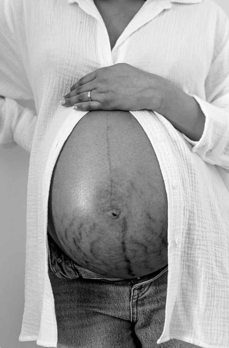 وين الماميات الحلوات لي على وشك ولادة  جبتلج عرض يجنن مشد يشد البطن وزيت بايو اويل  وديرما رول 
 يستخدم الخطوط البيضاء 
 والخطوط الحمراء يستخدم الخطوط لي بعد ولادة  ويستخدم الخطوط لي صير بسبب السمن والضعف  سعر العرض 38 متوفر توصيل توصيل مجاني عرض شهر رمضان المبارك البصرة, العراق


**إذا كنت صاحب هذا الإعلان وتريد حذفه لأي سبب، رجاءا أرسل رسالة إلى الدعم الفني**