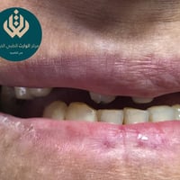 تجميل أسنان • د ثائر عباس • الناصرية شارع بغداد