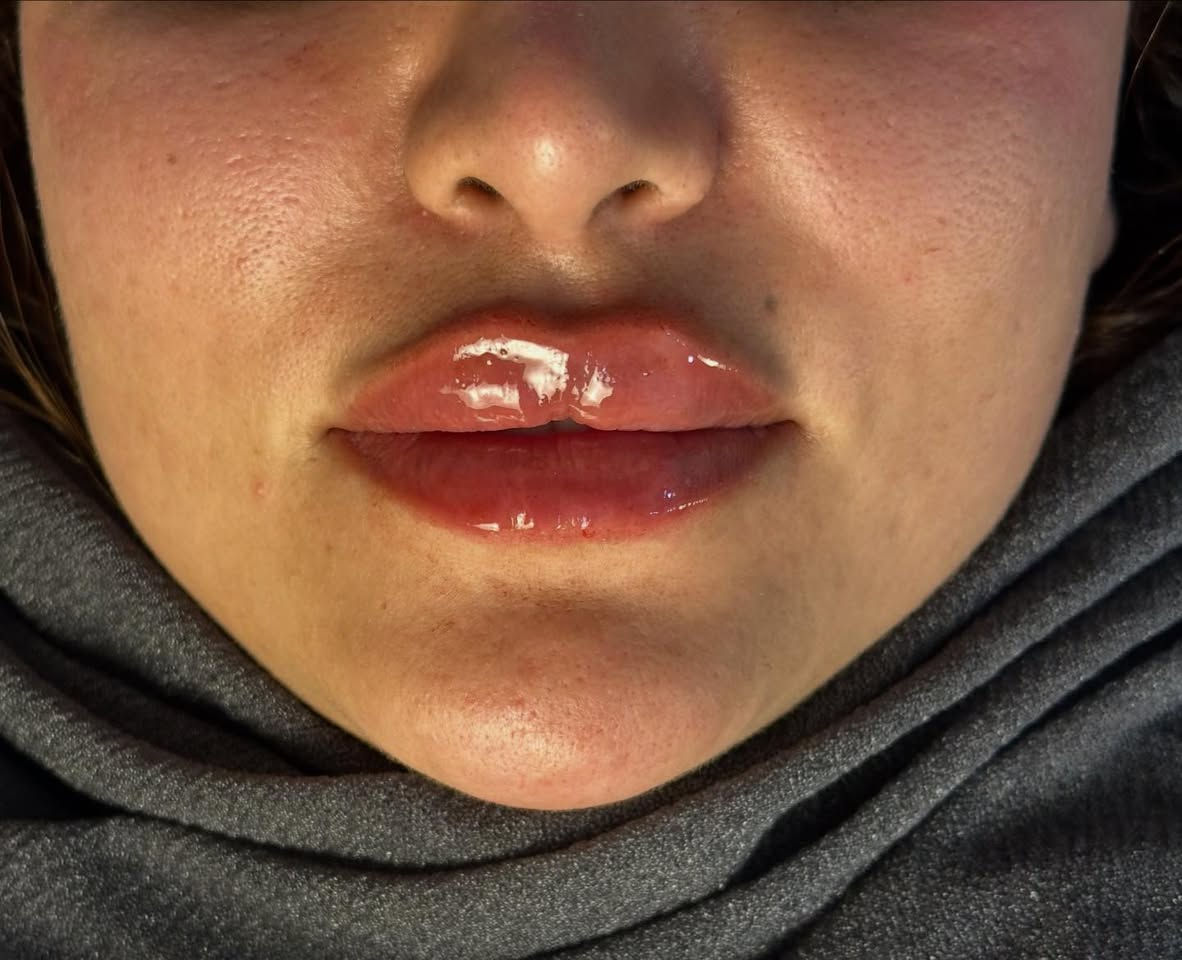 #فيلر


**إذا كنت صاحب هذا الإعلان وتريد حذفه لأي سبب، رجاءا أرسل رسالة إلى الدعم الفني**