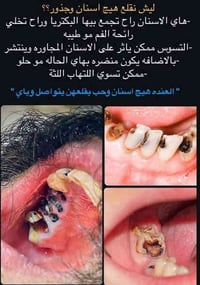 تعلن عيادات  اللصفوه التخصصية لطب الأسنان عن بدء استقبالها للمراجعين و...