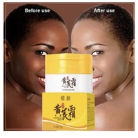 كريم • تبييض • إزالة نمش