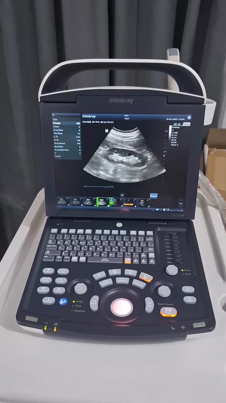 توفر جهاز سونار بورتبل موديل Mindray DP-10  سنة الصنع 2022 نظيف كلش مع بروب كونفكس يفيد عيادات النسائية والباطنية والبولية مع توفر بروب فجاينال جديد متوافق في حال حاجة الزبون لذلك وبسعر مناسب . للتواصل مراسلة الصفحة او الاتصال على الرقم *********** مهندس عماد .
#سونار_مستعمل 
#سونار 
Mindray
#Chison
اجهزة_طبية
