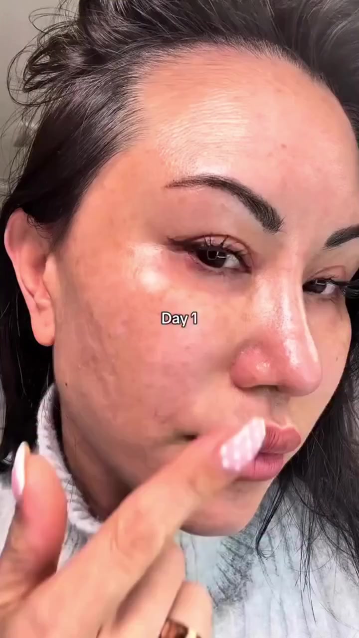 النمش والبقع الغامقة مو شي يروح بين يوم وليلة…
بس كريم Dr. Melaxin Dark Spot يشتغل خطوة خطوة.

خفيف على البشرة، يمتص بسرعة،
ويبدأ يحسن التفاوت اللوني مع الوقت.

اللي يعجبني؟
ما يحسسك بثقل أو دهون، يعني ممكن تدمجينه بسهولة مع روتينك اليومي.


**إذا كنت صاحب هذا الإعلان وتريد حذفه لأي سبب، رجاءا أرسل رسالة إلى الدعم الفني**