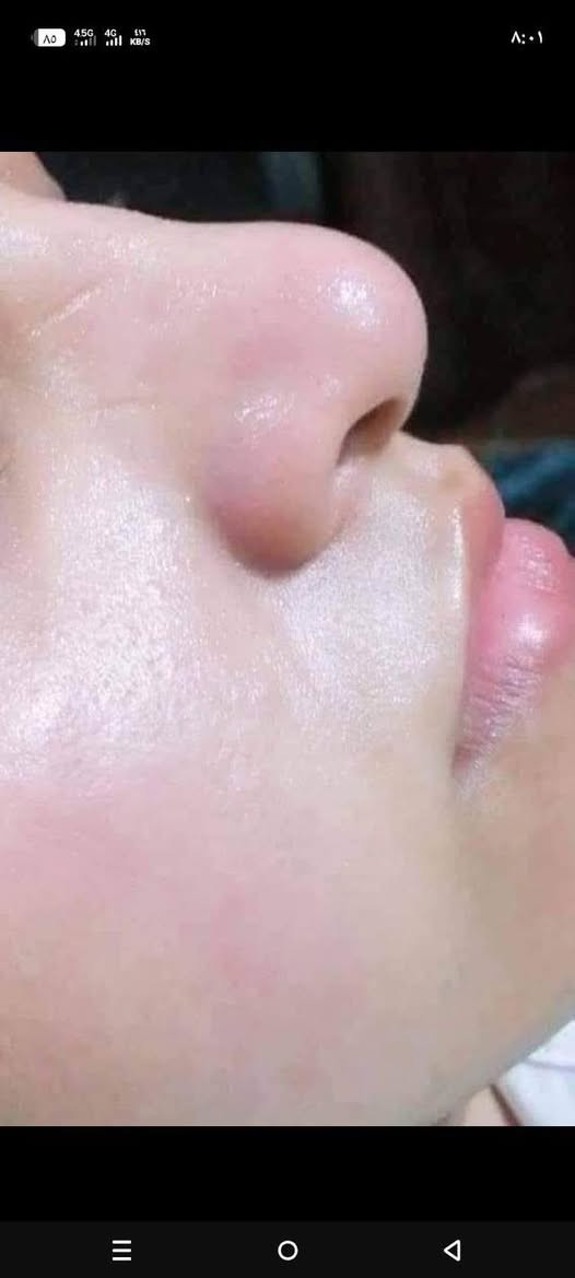 خلطات تبيض البشره ازالة الكلف والرؤس السوداء خلال يومين تبيض البشره شرط بمواد طبيه من الصيدليه وبظمان شرط اذا ماشتغلت ترجع وتاخذين فلوسچ ب15 الاف فقط وتوصيل مجاني داخل السماوه للحجز يرجى مراسلة الحساب


**إذا كنت صاحب هذا الإعلان وتريد حذفه لأي سبب، رجاءا أرسل رسالة إلى الدعم الفني**