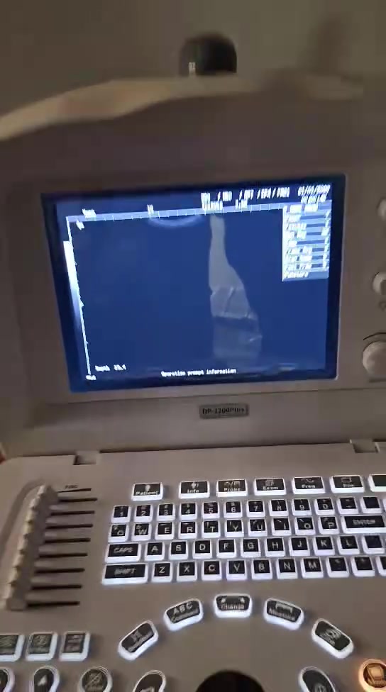 السلام عليكم جهاز سونار 
مندري  DP 2200 PLUS بورتبل الماني
بروب واحد لاينر
موديل ٢٠١٧ شغال للبيع
للاستفسار خاص أو الرقم ***********
