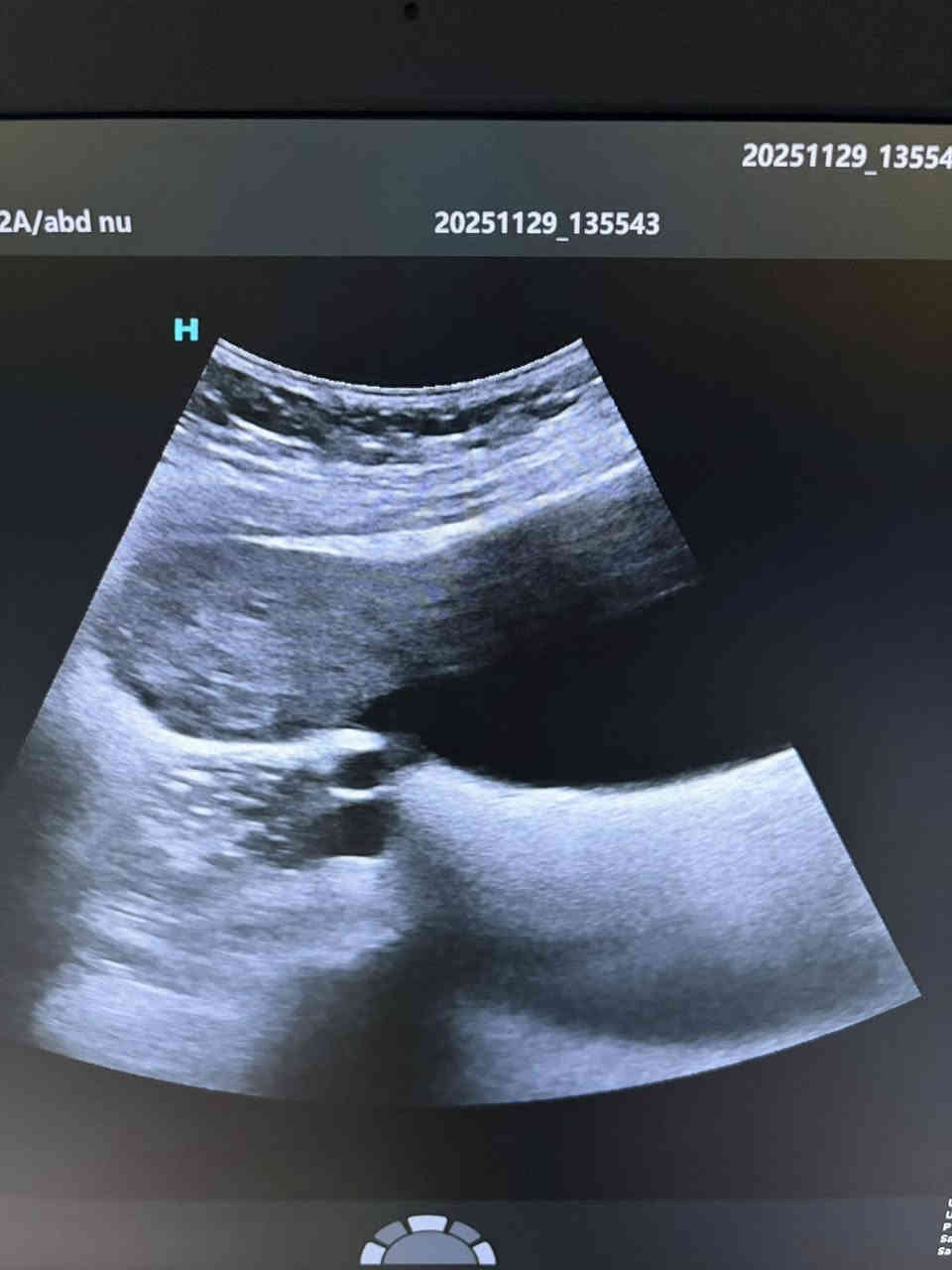 تتواجد غدا السبت ان شاء الله الدكتورة نهى فارس عطااللة الجبوري اخصائية الاشعة التشخيصية دكتوراه بورد عربي زميلة المجلس العربي للاختصاصات الصحية 
سونار ودوبلر ومفراس ورنين 
سونار ودوبلر البطن 
سونار ودوبلر اوردة وشرايين الاطراف العليا 
سونار ودوبلر اوردة وشرايين الاطراف السفلى 
سونار الثدي وسونار الغدد 
سونار ودوبلر العضلات والمفاصل 
سونار الدماغ للأطفال وسونار الخلع الولادي 
سونار الجلد وسونار العين 
يوجد في العيادة اشعة ملونة لفتح الانابيب 
عنوان العيادة القيارة شارع البيكمات مجمع الكوثر الطبي مقابيل روتانا مول 
اوقات دوام العيادة من الساعة الواحدة ضهرا إلى الساعة السابعة مساءا 
يوم السبت ويوم الأربعاء من كل اسبوع 
للحجز والاستفسار الاتصال على رقم العيادة ***********
