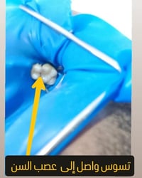 عيادة الناحية • علاج عصب • مجاور الرحمة