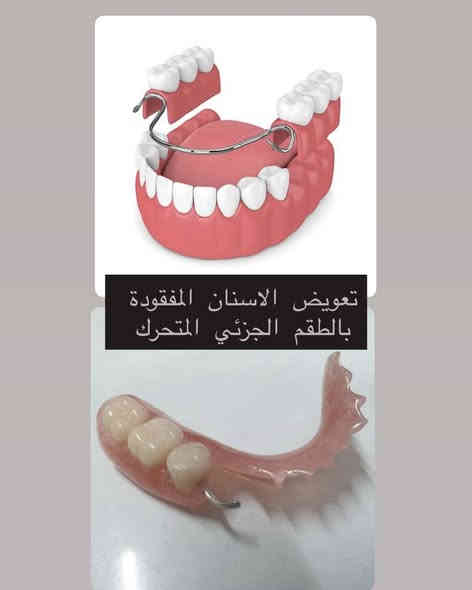 تبحث عن علاج مجاني وآمن؟✨ 
نلتقيكم في عياداتنا!
📅 بدأنا نستقبل الحالات في عيادات جامعة كركوك !

🔹 الخدمات المتوفرة:
 •قلع الأسنان
 •الحشوات
 •تنظيف الأسنان
 •أطقم الأسنان

سارعوا بالحجز، الحجوزات محدودة !

💌 للحجز والتفاصيل: مراسلة الصفحة او التواصل على الرقم ***********
