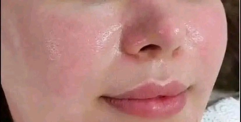 #تخفيضات العيد 😍قطع اخيرة 
السعر السابق 15❎
السعر الحالي 10✅


**إذا كنت صاحب هذا الإعلان وتريد حذفه لأي سبب، رجاءا أرسل رسالة إلى الدعم الفني**