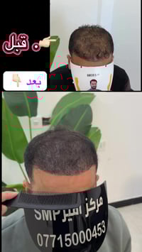 مركز امير SMP اخفاء فراغات الشعر العنوان بغداد اربيل بصرة 07715000453