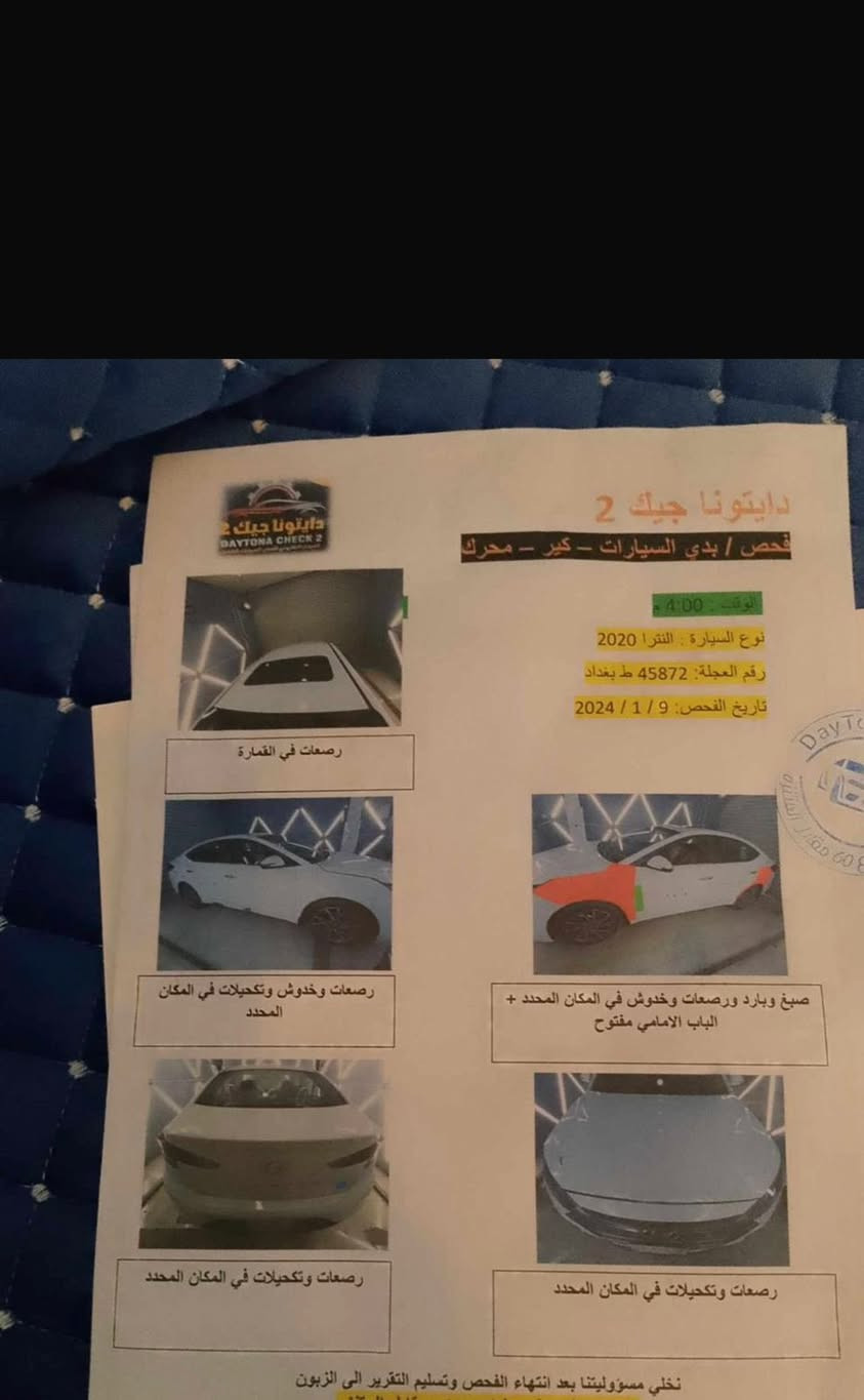 السلام عليكم
سياره النترا خليجي للبيع مديل ٢٠٢٠ سياره بسمي رقمه بغداد انكليزي مشروع وطني كما موضح بالصور لا تخابرني وتكلي شبيهه ما بيهه السونار كدامك واضح
مكاني ناصريه مركز
السعر/160 وبيهه مجال قليل
رقم الهاتف/***********
