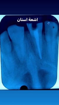 عيادة اسنان • تقويم وزراعة • الامين الثانية