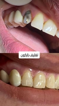 إذا تبحث عن العناية بأسنانك بأيدي خبير، زور عيادة الدكتور هاشم غسان. ✅...