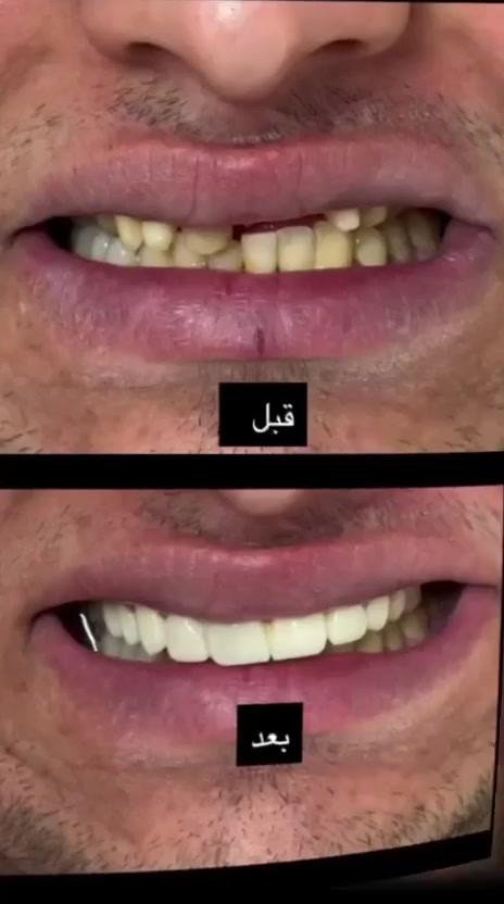 عيادة البركه الطبيه الخيريه
حي العامل شارع المضخه
مقابل بيت مطشر 
للاتصال***********
