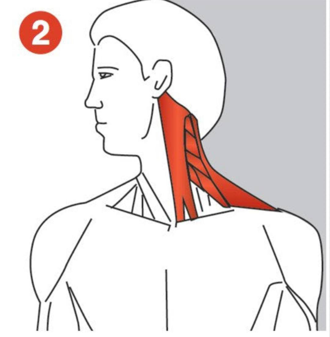 🌿 هذه أفضل تمارين لتخفيف ألم نقاط الزناد (Trigger Point) في الرقبة واليد بطريقة سهلة وآمنة 👇
🧠 أولًا: تمارين نقاط الزناد للرقبة
🔹 1. إطالة الرقبة الجانبية
الطريقة:
اجلسي مستقيمة
ميّلي رأسك إلى جهة واحدة
استخدمي يدك لزيادة الإطالة بلطف
المدة:
20–30 ثانية
كرري 3 مرات لكل جهة
👉 يفيد في:
شد الرقبة
الصداع الناتج من العضلات
🔹 2. شد عضلة أعلى الكتف (الترابيس)
الطريقة:
امسكي رأسك واسحبيها للأمام وللجانب
الكتف يبقى ثابت للأسفل
👉 مفيد جدًا لنقاط الزناد في الكتف
🔹 3. تمرين لف الرقبة
الطريقة:
لفي رأسك ببطء يمين ويسار
بدون ألم قوي
التكرار:
10 مرات
💪 ثانيًا: تمارين نقاط الزناد لليد والذراع
🔹 1. إطالة الساعد (مهم جدًا)
الطريقة:
مدي يدك للأمام
اسحبي الأصابع للخلف باليد الأخرى
👉 يفيد في:
ألم الرسغ
شد العضلات
تنميل اليد
🔹 2. إطالة المعصم العكسية
الطريقة:
مدي يدك
اضغطي الأصابع للأسفل
👉 يخفف نقاط الزناد في الجهة الأخرى من الساعد
🔹 3. تمرين الكرة (تقوية + تفريغ شد)
الطريقة:
امسكي كرة صغيرة
اضغطي عليها ثم ارخي
التكرار:
15–20 مرة
🎯 تمرين مهم جدًا (إزالة نقطة الزناد مباشرة)
🔹 الضغط العلاجي
الطريقة:
حددي النقطة المؤلمة
اضغطي عليها بإبهامك
استمري 30–60 ثانية
👉 ستشعرين:
بألم بسيط ثم يبدأ يخف = هذا طبيعي
واذا لم تشعري بتحسن بهذه التمارين عليك مراجعة علاج طبيعي بااسرع وقت 
الاخصائية المعالجة الفيزيائية
 العنوان 
بغداد المشتل قرب مستوصف المعلمين النموذجي باتجاه المدارس او قرب فلافل علاوي  للحجز والاستفسار مراسلة رقم الواتساب 
*********** معالجة للنساء 
*********** معالج للرجال
