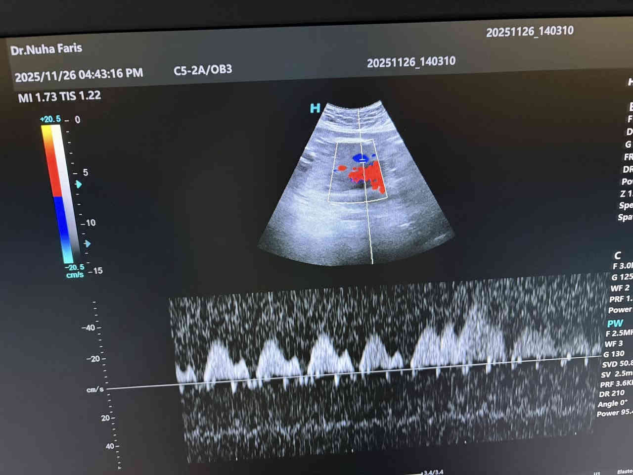 تتواجد غدا السبت ان شاء الله الدكتورة نهى فارس عطااللة الجبوري اخصائية الاشعة التشخيصية دكتوراه بورد عربي زميلة المجلس العربي للاختصاصات الصحية 
سونار ودوبلر ومفراس ورنين 
سونار ودوبلر البطن 
سونار ودوبلر اوردة وشرايين الاطراف العليا 
سونار ودوبلر اوردة وشرايين الاطراف السفلى 
سونار الثدي وسونار الغدد 
سونار ودوبلر العضلات والمفاصل 
سونار الدماغ للأطفال وسونار الخلع الولادي 
سونار الجلد وسونار العين 
يوجد في العيادة اشعة ملونة لفتح الانابيب 
عنوان العيادة القيارة شارع البيكمات مجمع الكوثر الطبي مقابيل روتانا مول 
اوقات دوام العيادة من الساعة الواحدة ضهرا إلى الساعة السابعة مساءا 
يوم السبت ويوم الأربعاء من كل اسبوع 
للحجز والاستفسار الاتصال على رقم العيادة ***********
