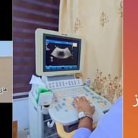 سونار حمل • دوبلر ملون • مجمع الحياة الطبي
