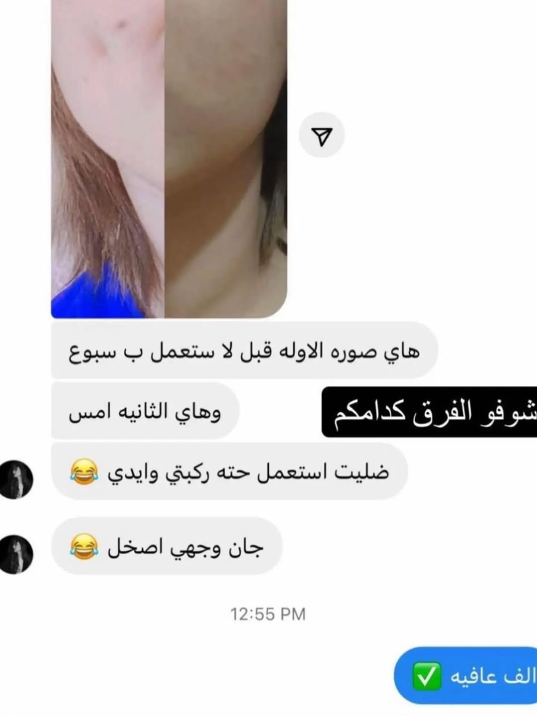 منو بعدها ماجربت خلطتي 
الوجة ثلج خلال 8 أيام 
كلف ماكو نهائيآ ومن تنترك مراح تأثر على الوجة 

اول سبوع تتخلى يومية 
ثاني اسبوع تتخلى بين يوم ويوم 
وثالث اسبوع تتخلى كل 3 ايام 
النتائج راح تبين أول 5 أيام 
الخلطة وحدها 15 مع الصابونه 20 
للطلب مراسلة الصفحة


**إذا كنت صاحب هذا الإعلان وتريد حذفه لأي سبب، رجاءا أرسل رسالة إلى الدعم الفني**