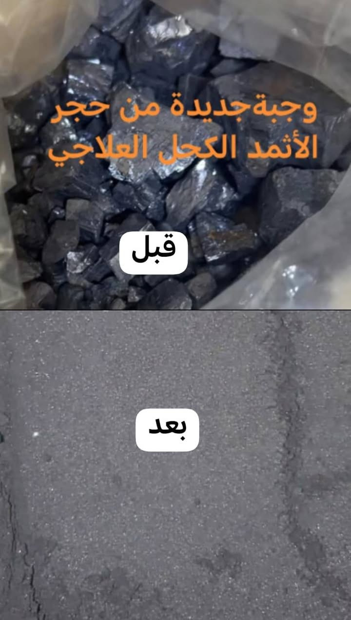 كحل الأثمد ✨ الأصلي ✨
أولاً: أحاديث النبي ﷺ عنه:
وردت عدة أحاديث عن فضل كحل الأثمد، منها:
قال رسول الله ﷺ:
"إنَّ مِن خيرِ أكحالِكم الإثمد، إنه يجلو البصر، وينبت الشعر."
✨ يجلو البصر: أي يساعد على تقوية النظر وصفاء العين.
✨ ينبت الشعر: يُقصد به شعر الرموش ويزيد من كثافتها.
✨ تنظيف العين: يساعد في إزالة الأوساخ الخفيفة.
✨ تقليل التهابات بسيطة (إذا كان نقي وأصلي).
تنبيه مهم ⚠️
لازم يكون أثمد طبيعي ونقي 👆💎
متوفر جملة ومفرد  
ملاحظة ❌يجيج بكج كحل مع مكحلة العلبة تمليلج المكحلة 3 مرات 😍😍


**إذا كنت صاحب هذا الإعلان وتريد حذفه لأي سبب، رجاءا أرسل رسالة إلى الدعم الفني**