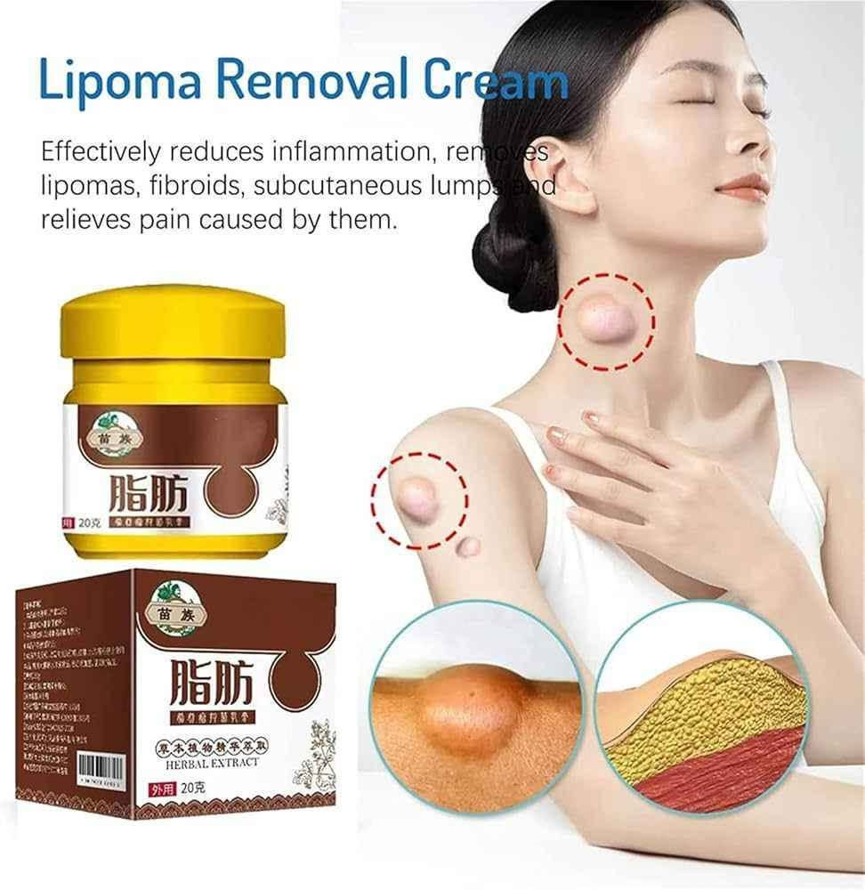 كريم إزالة الأورام الشحمية منFDTY eelhoe LIPOMA.   Soothing Cream HERBAL ESSENCE EXTRACTION) RESTORE SKIN SMOOTHNESS
✨ كريم طبيعي بالأعشاب لإزالة الأورام الشحمية الفوري، للتكتلات تحت الجلد وتجمعات الدهون المختلفة، ولتخفيف الألم.

✨إزالة الأورام الشحمية: يُفتت الدهون الزائدة ويُحفّز تكوين العقيدات تحت الجلد. بفضل هذا المنتج، يُمكنك إزالة الأورام الشحمية بفعالية ودون أي مضاعفات.

✨ كريم عميق التغلغل وسهل الامتصاص يُخفف الانزعاج. تركيبة طبيعية غير دهنية تُذيب الأورام الشحمية دون جراحة.

✨يُحسّن الدورة الدموية يُساعد على  التخلص من الأورام الشحمية في الأوردة عن طريق تعزيز الدورة الدموية وتقليل الضغط. كما يُمكنه تخفيف أعراض دوالي الأوردة وتحسين الدورة الدموية في النهاية.

✨ تأكد من أن المنطقة المُصابة نظيفة وجافة. ثم دلكي الكريم بلطف بيديك من مرتين إلى ثلاث مرات يوميًا للحصول على أفضل النتائج.
#الاصلي 💯✅ 
السعر 25الاف 
🚘يوجد خدمة توصيل لجميع محافظات العراق 5 الاف 🚘 بغداد, العراق


**إذا كنت صاحب هذا الإعلان وتريد حذفه لأي سبب، رجاءا أرسل رسالة إلى الدعم الفني**