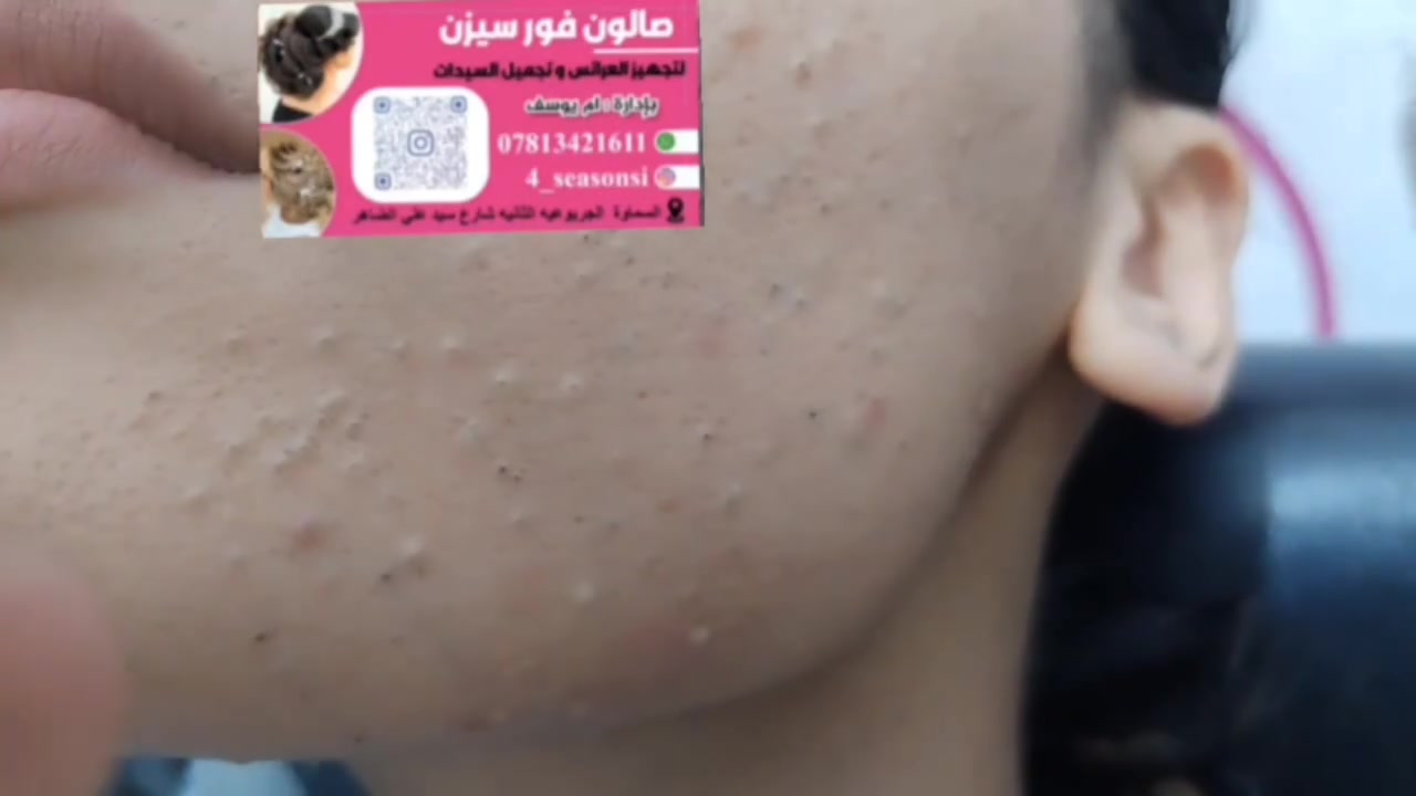 يقدم لكم صالون
 فور سيزن للسيدات 
عرض خاص 
جلسه ملكيه للبشره 

العنوان السماوه
 الجربوعيه الثانيه 
شارع سيد علي الضاهر الرئيسي قرب السيطره القديمه

يرجى الانتباه  
الحجز مسبق 
ويحدد السعر بعد المقابله 

تابعونا انستا 
https://www.instagram.com/reel/DUXv4WsDP_g/?igsh=MWR5OWlyc3VsaHNxeA==

يرجى الانتباه الحجز مسبق 

واتساب ***********
