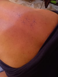 مريض يعاني من خدر في أصابع اليد اليمنى ...  لكينه المشكله في منطقة الظ...