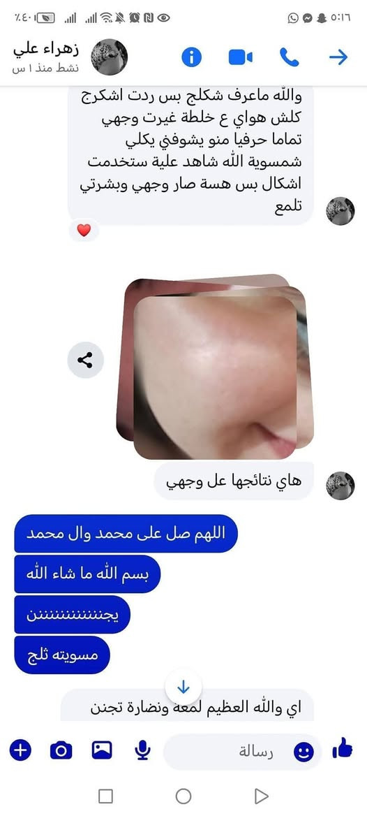 يابا وداعت جهالي وحق هذا الشهر الحرام إذا ما سويت وجهج بياض موووو طبيعي وخديداتج مورد هيح تجننن كأنما بشره طفل واني مسؤوله عن كلامي امام الله ورسوله وحق هذا الشهر وداعت جهالي تعالى شلعي عيوني مو بس الفلوس والله بنات شغلي كله براندات فرنسيه زيوت وكريمات طبيه وداخله كومة دورات وتعبانه ع نفسي بمجال صناعه الكريمات حت وصلت هيج مرحله انو اضمن شغلي للزبون وهسه كتجارب ما شاء الله بفضل رب العالمين أكثر من ٦٠٠ زبونه والله شاهد ع كلامي واني بنفسي جربت شغلي وداعت جهاالي كولششششش قويه وبأيدي مشتغلتها وأمانه الله لا درمودين ولا ملكير ولا اي شي يضر بصحة وسلامة البشره وكل هذا بسعر تنافسي ١٠ الاف تعالن غيرن بشرتجن  وخلن كلمن يشوفج يتعجب عليج كد ما تخلي البشره ثلج


**إذا كنت صاحب هذا الإعلان وتريد حذفه لأي سبب، رجاءا أرسل رسالة إلى الدعم الفني**