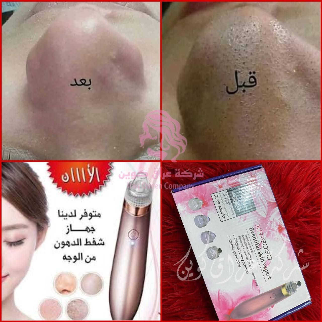 وجبة جديدة 
جهاز تنظيف البشره و شفط الدهون  💯 
جهاز شفط دهون البشرة جهاز عبقري يسحب دهون الوجه و الانف كلها ف اقل من 5 دقايق و الاهم انه يشيل الرؤوس السوداء من الجذور و ينظف مكانها 
السعر 18الف فقط


**إذا كنت صاحب هذا الإعلان وتريد حذفه لأي سبب، رجاءا أرسل رسالة إلى الدعم الفني**