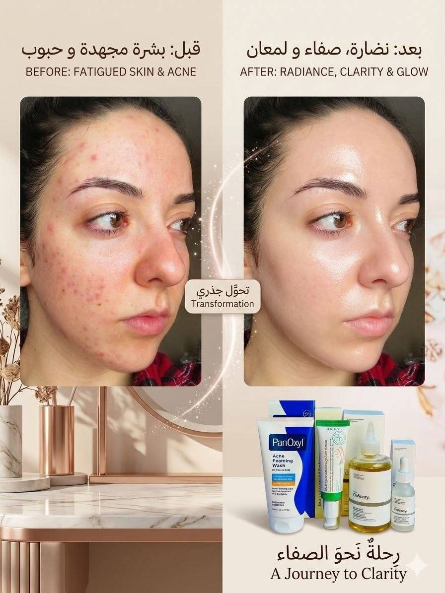 ✨ سر البشرة النقية صار بين إيدج! ✨

عرض متكامل لعلاج الحبوب وآثارها وتوحيد لون البشرة يشمل:
💙 غسول PanOxyl
💛 سيروم AXIS-Y
🤍 تونر الجلايكوليك + سيروم النياسيناميد من The Ordinary

🚚 توصيل لجميع محافظات العراق.

📩 احجزي عرضج الآن قبل نفاد الكمية. المدائن, بابل


**إذا كنت صاحب هذا الإعلان وتريد حذفه لأي سبب، رجاءا أرسل رسالة إلى الدعم الفني**