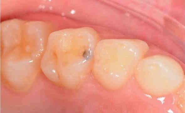 اللي من الناصريه ويحتاج حشوات اسنان يتواصل وياي العلاج مجاناً وتحت اشراف اطباء اختصاص
