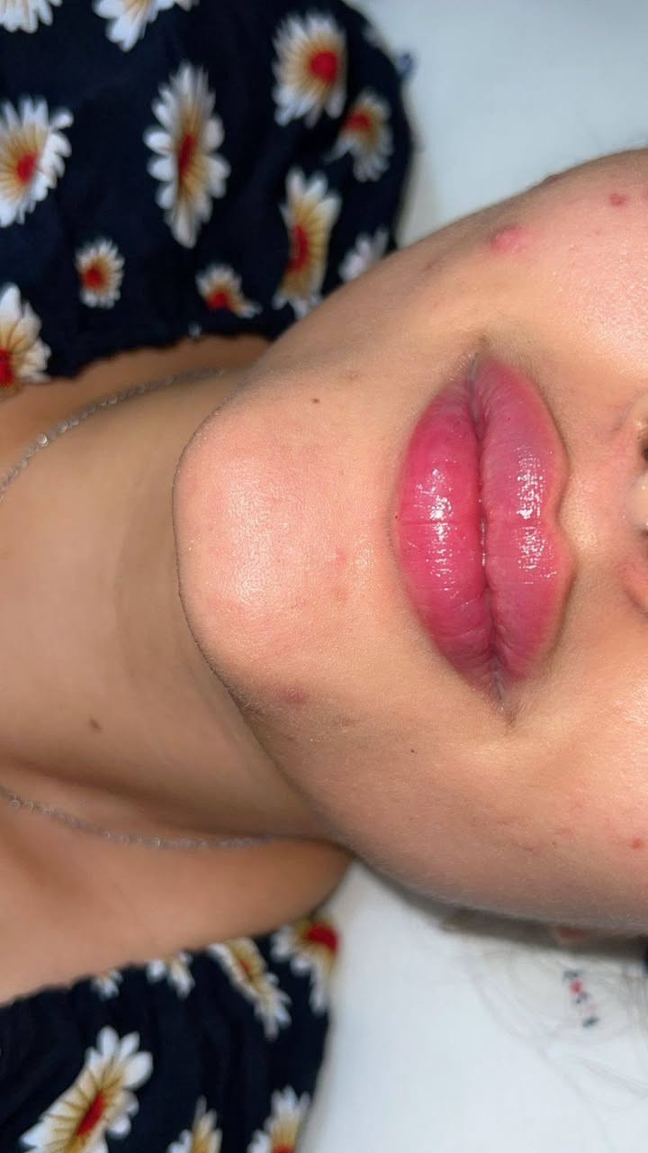 ***********
تصال ستفسار ع رقم
