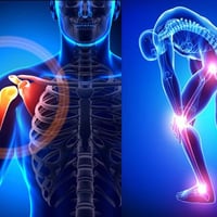 علاج مفاصل • عرگ النسا • شارع 60