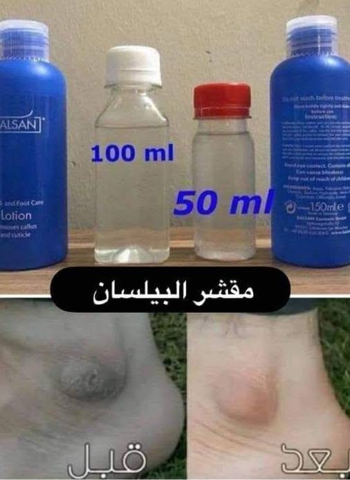 مقشر بلسان Balsan
( التقشير الكيمياوي للجسم ) الالماني 🇩🇪🇩🇪الاصلي💯 ✅

اقوى مقشر ومفتح اماكن غامقة يعمل على ازالة الجد المتثخن والاسمرار الحاصل في الرقبة والركب والايدي والكوع والارجل .. وازالة الجلد الميت ويعتبر افضل علاج للاقدام المتششقه نتائج سريعة جداً جدأ. 💯✅

لتفتيح مناطق الكوع وباقي اجزاء الجسم الي تعاني من سواد مزعج 

بنات هذا المقشر راح ايعالج اي منطقه خشنه او يابسه او بيها سواد قوي وصعب علاجه منتج الماني اصلي 💯💯💞

طريقة استعمال مقشر بيلسان 👇👇

1. لازم اتكون البشره الي انريد نستعمل عليها المقشر ان تكون يابسه ومو رطبه
2. لازم تكون المنطقه غير حساسه🌸
3. اول شي انجيب قطن مكياج  تكون طبقه خفيفه انخليها عل منطقه 
4. انخلي البيلسان عل قطنه كميه تكون القطنه  كلش رطبه💧
5. انغطي المنطقه  ب كيس حتى نحصل على ترطيب اكثر للمنطقه
6. بعد 30 دقيقه تفتحون  الكيس وتوخرون القطن وجيبون اي شفره   اتقشرون بيها .

المنشأ الماني 🇩🇪💯💯
احذروا التقليد 🚫 
انتباه الاصلي الاصلي يمنا هوايه موجود التقليد بالبيجات باسعار جدا مناسبه لكن مو اصلي الي عدنه الماني الاصلي 🇩🇪💯💯
اذا مو اصلي ومو نفس نتائج الفيديو نرجعه.  
السعر ال٥٠ مل ١٤ الاف 
🚘 يوجد خدمة توصيل لجميع محافظات العراق


**إذا كنت صاحب هذا الإعلان وتريد حذفه لأي سبب، رجاءا أرسل رسالة إلى الدعم الفني**