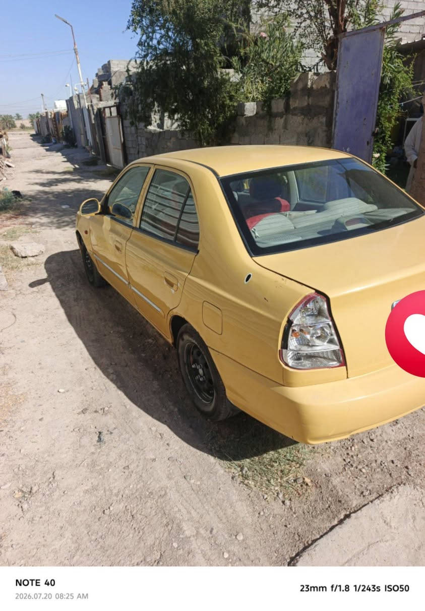 السلام عليكم
يوجد سياره للبيع فيرنا موديل ٢٠١٤ مكفوله گير ومحرك للاستفسار الاتصال بالرقم ***********
