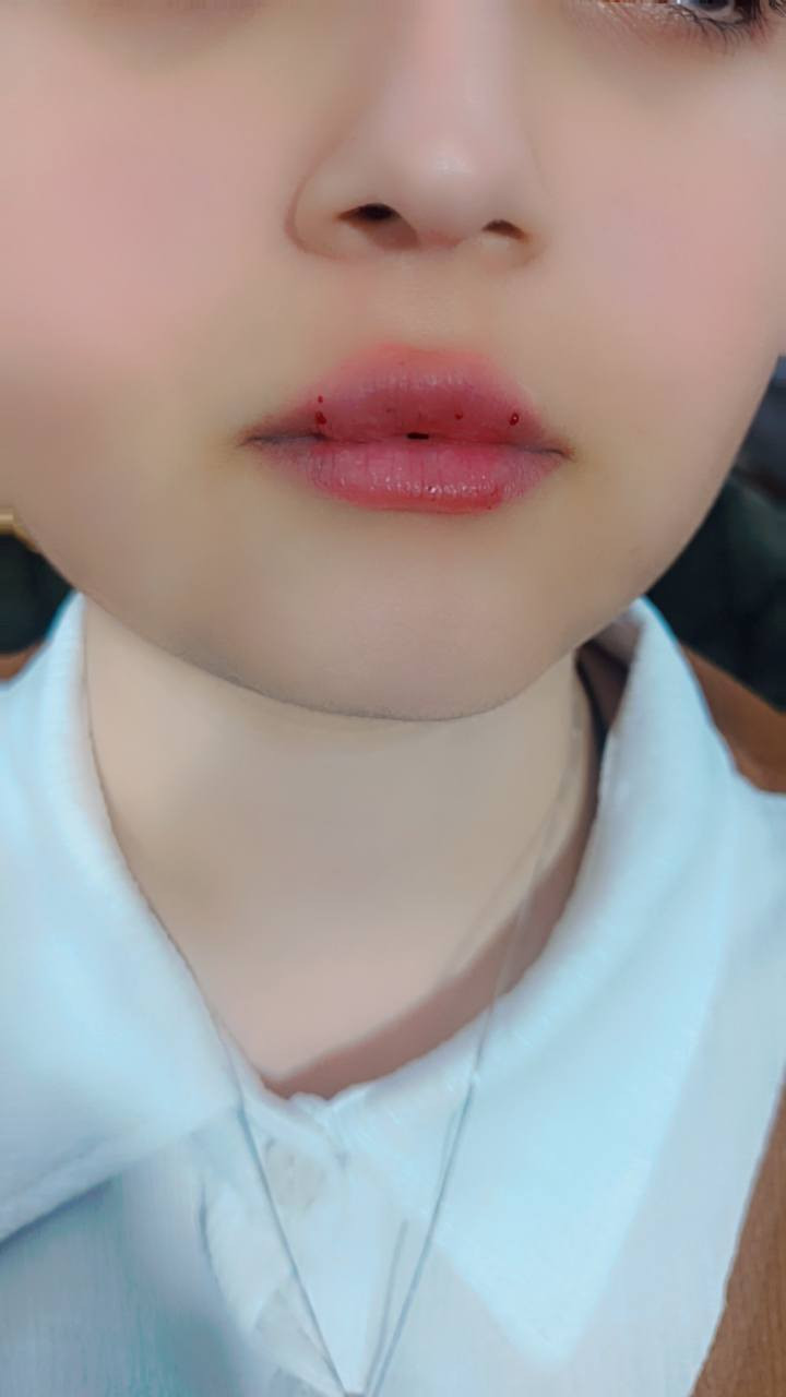 مستمرة عروض الفرررر


**إذا كنت صاحب هذا الإعلان وتريد حذفه لأي سبب، رجاءا أرسل رسالة إلى الدعم الفني**