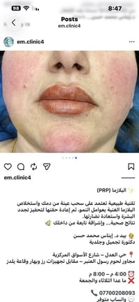 للحجز والاستفسار المراسله خاص او الاتصال ‭0770 020 8093‬