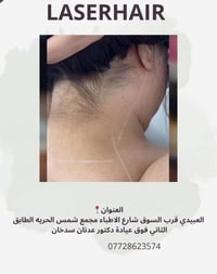 ليزر ازاله شعر الرقبه 🤗🤗🤗 العنوان العبيدي شارع الاطباء مجمع شمس الحريه...