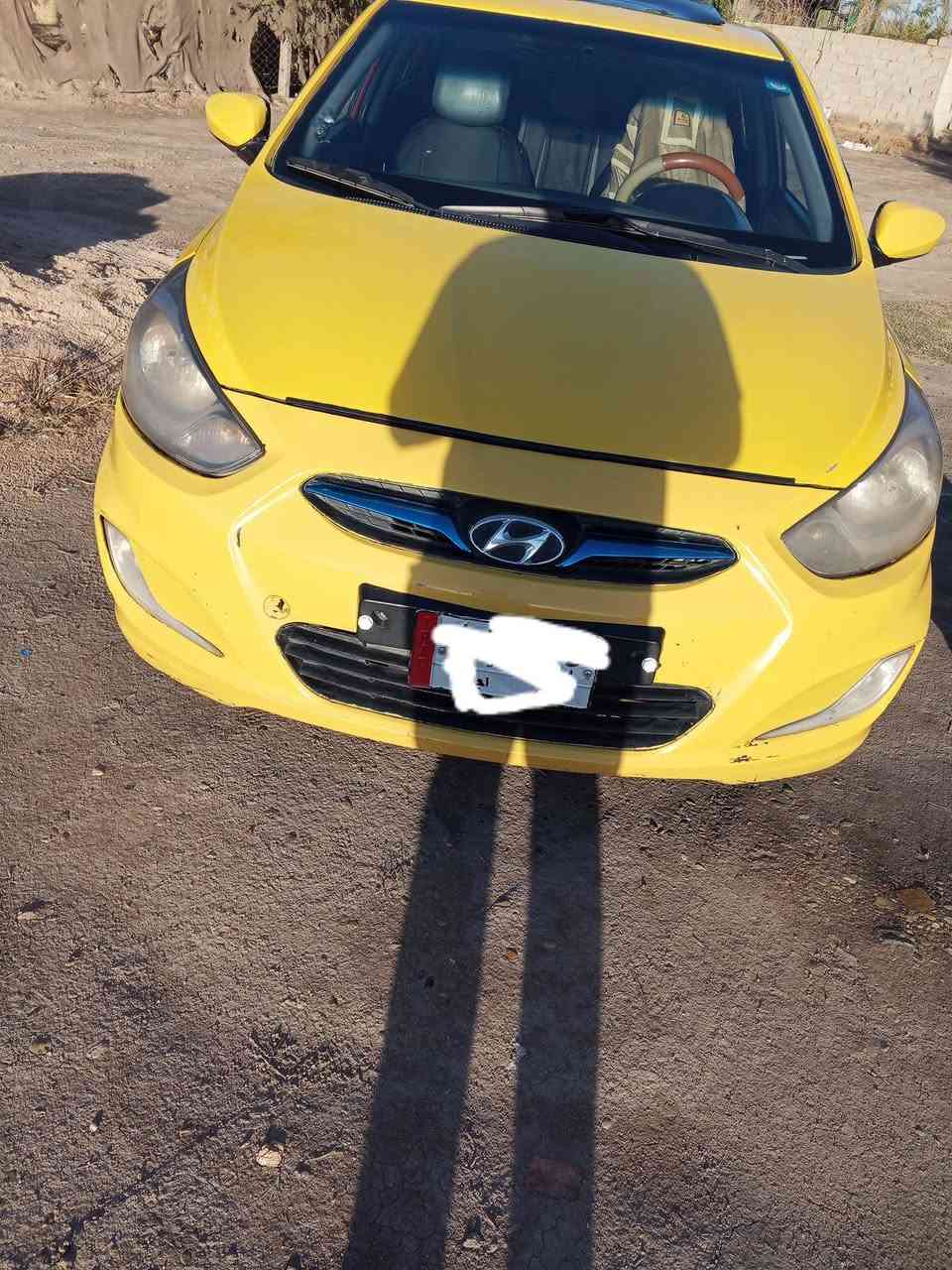 سلام عليكم اكسنت وارد امريكي 14
حادث جاملغ خلفي 
سياره بسمي سنويه 2028
اسياره جوه تخم تاير جديد 
منضومت زنون
  سياره مستحقه 
دواخل كامله 
سياره   
سعر85$
او بيه مجال حك المكينه  ‏‪***********‬‏ مامتواجد علا الفيس
