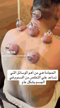 حجامه عنوان بغداد البياع حي شهداء خلف سوق رضا رقم الحجز07811030900
