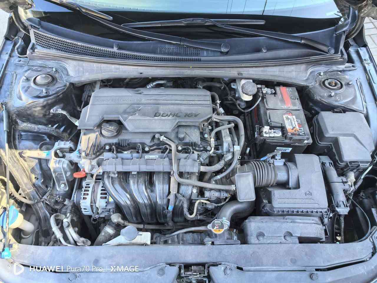 النترا ٢٠٢٣ وارد امركي مابيه داخل وصور الحادث مرفقه وبلعراق صار بيها ٣ قطع ماشيه ٩٦ الف وبيها سونار رقم اربيل راعيها كردي يريد تحويل مابيها نقص نهائي 5nplm4ag5ph102279 وهذا رقم الشاصي السعر ١٢٨ ورقه الاستفسار  ***********
