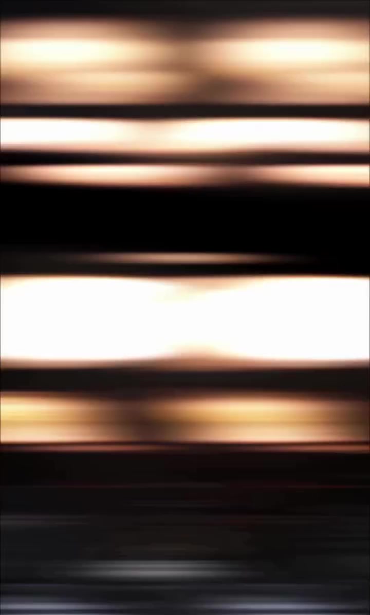 تورم حول العين ناتج عن سن متروك لفترة طويلة ، مما أدى إلى انتشار العدوى وتأثير واضح على المظهر الصحي للمنطقة بعد تقييم وتشخيص دقيق، تم استكمال علاج قنوات الجذر (Root Canal Therapy) بالشكل الأمثل، مع متابعة دقيقة لضمان إزالة العدوى واستعادة الوظيفة الكاملة للسن حتى استعادت المراجعة جمال ابتسامتها ووظيفة السن بشكل مثالي، مع تحسن واضح في صحة الأنسجة المحيطة ،التشخيص المبكر والعلاج المتخصص هما العاملان الرئيسيان لتحقيق أفضل النتائج، حتى في الحالات المعقدة والمتروكة لفترات طويلة.
By ‪@dr_hamza_alaa‬ 
للحجز والأستفسار مراسلة الصفحة او عن طريق الواتساب *********** 📞
العنوان بسماية الشارع العام 📍⁩
