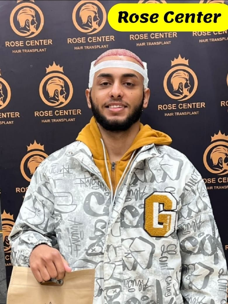 ❤️‍🔥كلينك روز ❤️‍🔥
العيادة الطبية الاولى في بغداد المجازة قانونيا للعمل في مجال زراعة الشعر ✨
( المانحات الضعيفة والاقتطاف من منطقة  اللحيه اختصاصناااا ‎%‎ )

- كوادرنا طبية فقط بدون خبراء او ممارسين يعني أمان وضمان مدى الحياة  100‎%‎
- ⁠صالات عمليات vip مجهزة باحدث الأجهزة ومصممة خصيصا لإجراء عمليات زراعة الشعر 
- ⁠فتح القنوات بالشفرات الياقوتية ( كثافة اعلى ، ضمان عدم حدوث اي التهاب بالمنطقة المزروعة )
- ⁠تخدير المنطقة المانحة والمزروعة  حقن الماني بدون الم اوالكريم الفرنسي او جهاز الكومفورت (حسب طلب العميل )
- ⁠8 جلسات بلازما مدعمة بالميزوثيربي بالإضافة 
2جلسه نضاره لبشره تبيض وشد

- ⁠أكيد عدد البصيلات مفتوح وبدون ترك اي اثر في المنطقة المانحة وفي حال ضعف المانحة خلف الراس يتم القطف او اللحية (حسب طلب العميل ) وبعد اجراء فحص البصيلات لضمان نجاح نقل البصيلات وزراعتها بشكل آمن ومضمون 

- ⁠أكيد وجبة طعام صحية حسب طلب العميل 

ملاحظة مهمة🦈 : العيادة مجازة ورسمية وتحت إشراف طبيب جلديه د. احمد عماد عبد الخالق والكادر المساعد حصرا ملاكات طبية وتمريضية 

الحجوزات محدودة للاستفسار والتواصل:/ /
 ☎️ ***********

 📍بغداد / المنصور /شارع 14 رمضان /داخل فرع المطابخ الهكر الالماني
