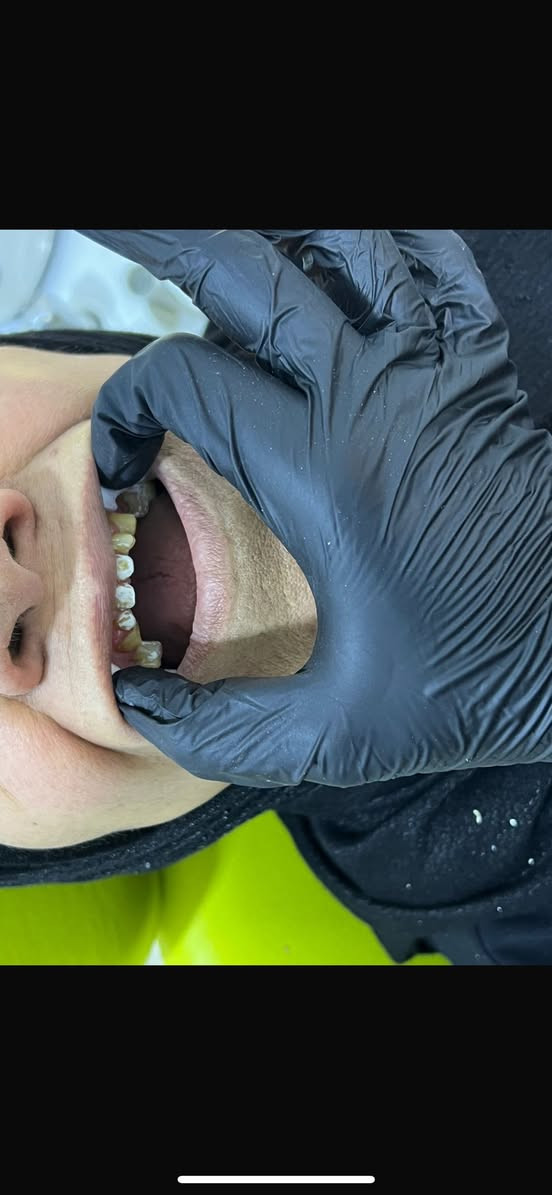 ✨ عيادة الدكتورة سميرة مهدي جاسم لطب الأسنان ✨

ابتسامتك أجمل معنا 😍

📢 عروض وتخفيضات خاصة لفترة محدودة:
🦷 تخفيض على حشوات الأسنان
🦷 تخفيض على تنظيف وتلميع الأسنان
🦷 أسعار مميزة لعلاج العصب
🦷 استشارات وفحص بأسعار مناسبة

✔️ عناية متكاملة بأحدث الأجهزة
✔️ جودة ودقة في العلاج
✔️ راحة واهتمام بكل مريض

📍 للحجز والاستفسار يرجى التواصل عبر الهاتف *********** أو زيارة العيادة. في الدورة بداية هور رجب مقابل افران الزيتون

🌟 اغتنم فرصة التخفيضات واحصل على ابتسامة صحية وجميل
