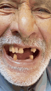 ✅رجعنا ابتسامه الحجي 🔥🥰🦷مراجعنا العم الطيب من خلال عمل تركيبات الاسنان في عيادتنا على يد دكتور محمد ناصر
—————————————١١١————————
نستقبلكم بكل حب يوميا بالعياده حله بدايه شارع الاطباء قرب المتوسطة المركزيه عياده الرياحين لطب وتجميل الاسنان 
*********** للحجز واتساب 
#اسنان #ابتسامه #تركيبات_أسنان
